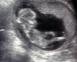 12._het_1._nap_41-54_mm_14gramm.jpg
