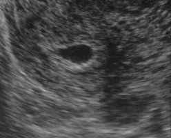 4.het_3-6mm.jpg